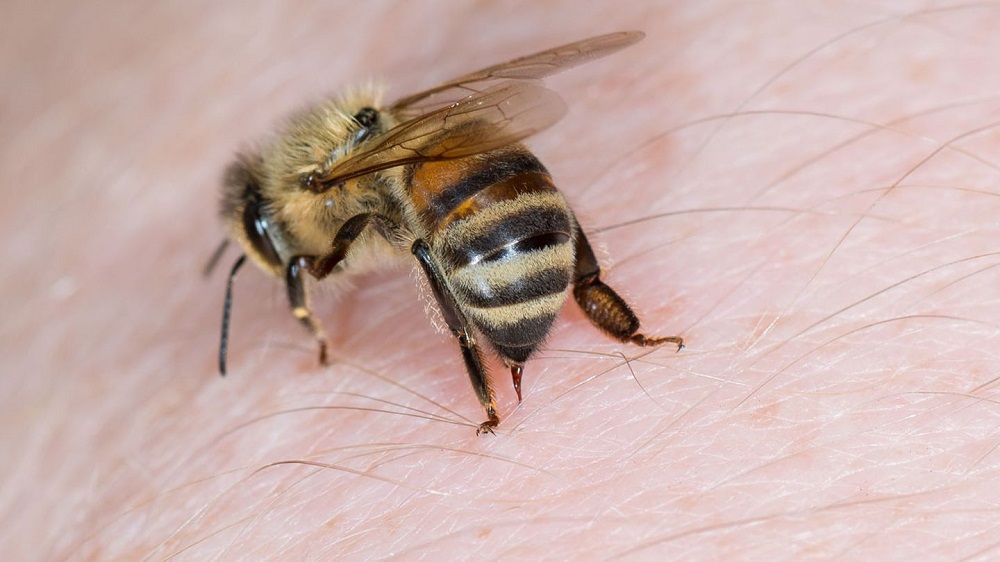 Công Dụng Bất Ngờ Của Nọc Ong Trong Làm Đẹp - Làm Điệu